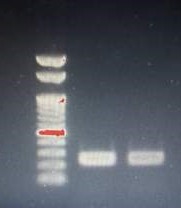 cDNA gel